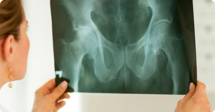 Pelvic and hip mobile X-ray service