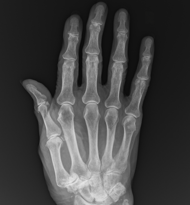 Extremities X-ray example