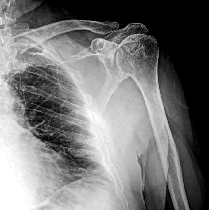Joints X-ray example